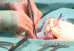 Frankfurter Uniklinik transplantiert keine Herzen mehr